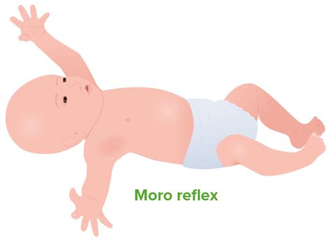 Ilustrácia reflexov novorodenca, napr. Moroov reflex